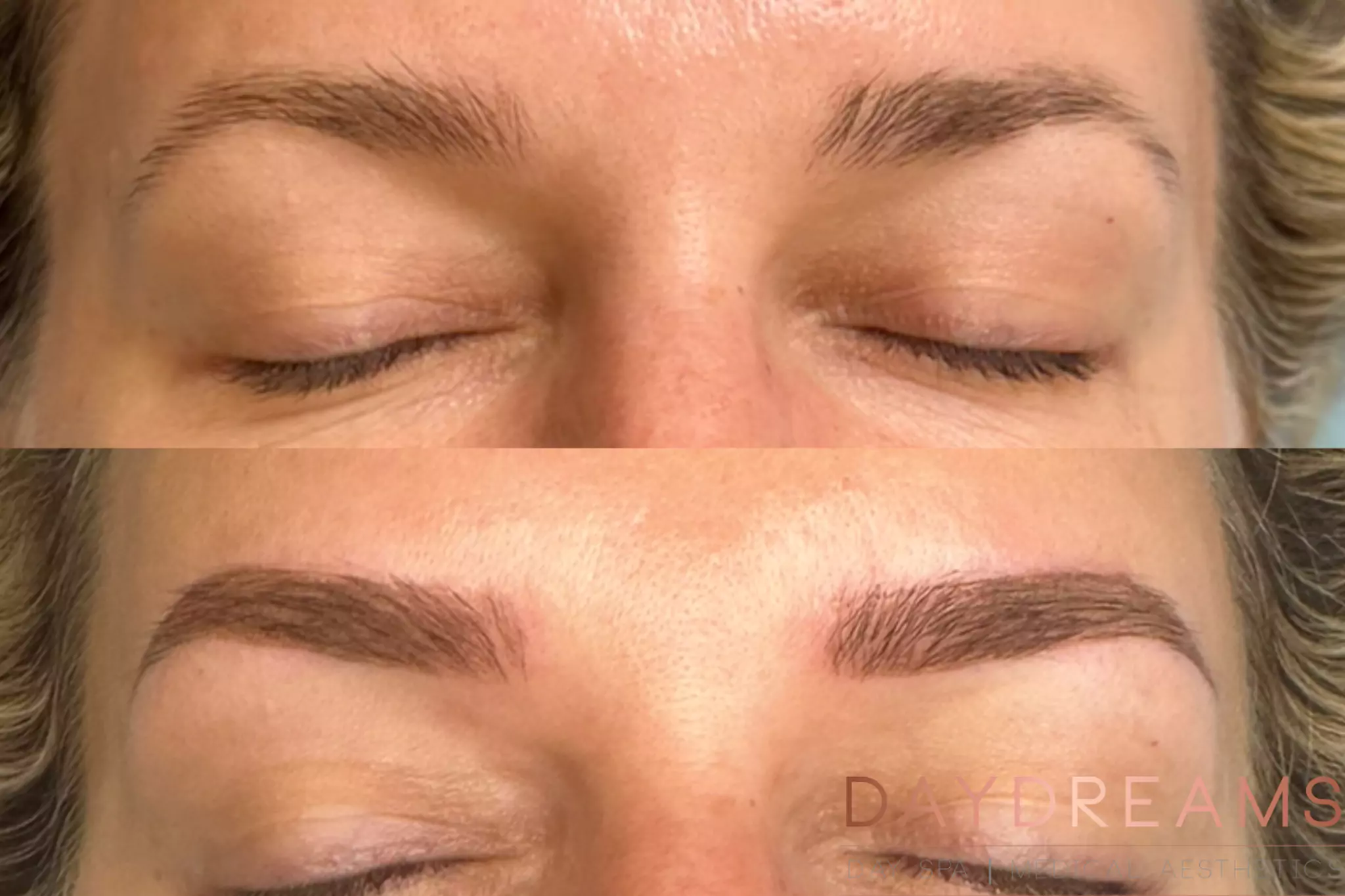 Combo Micro Powder before after 2