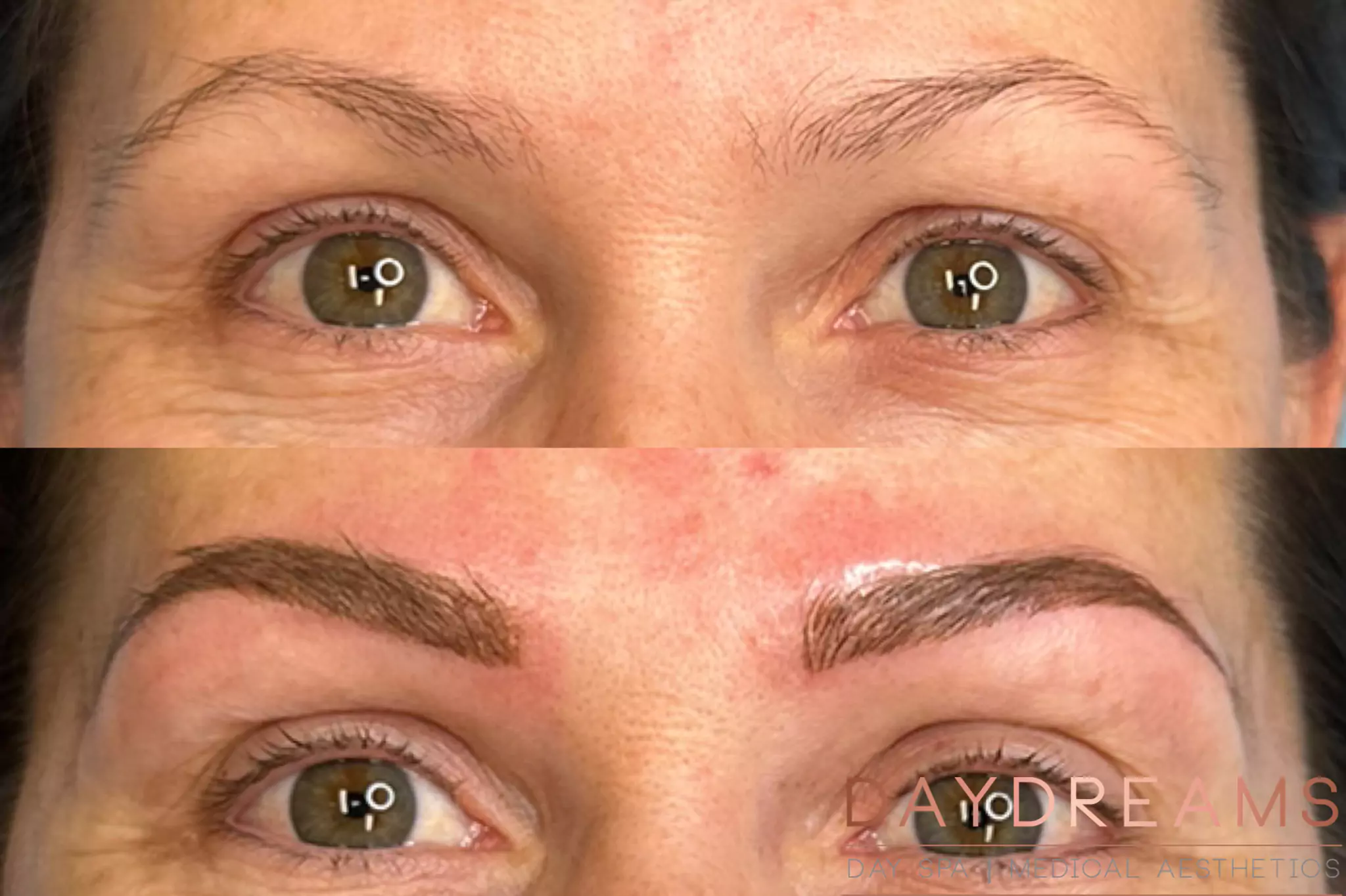 1-Combo-Mocro-Power-before-after Combo micro powder before after image 1