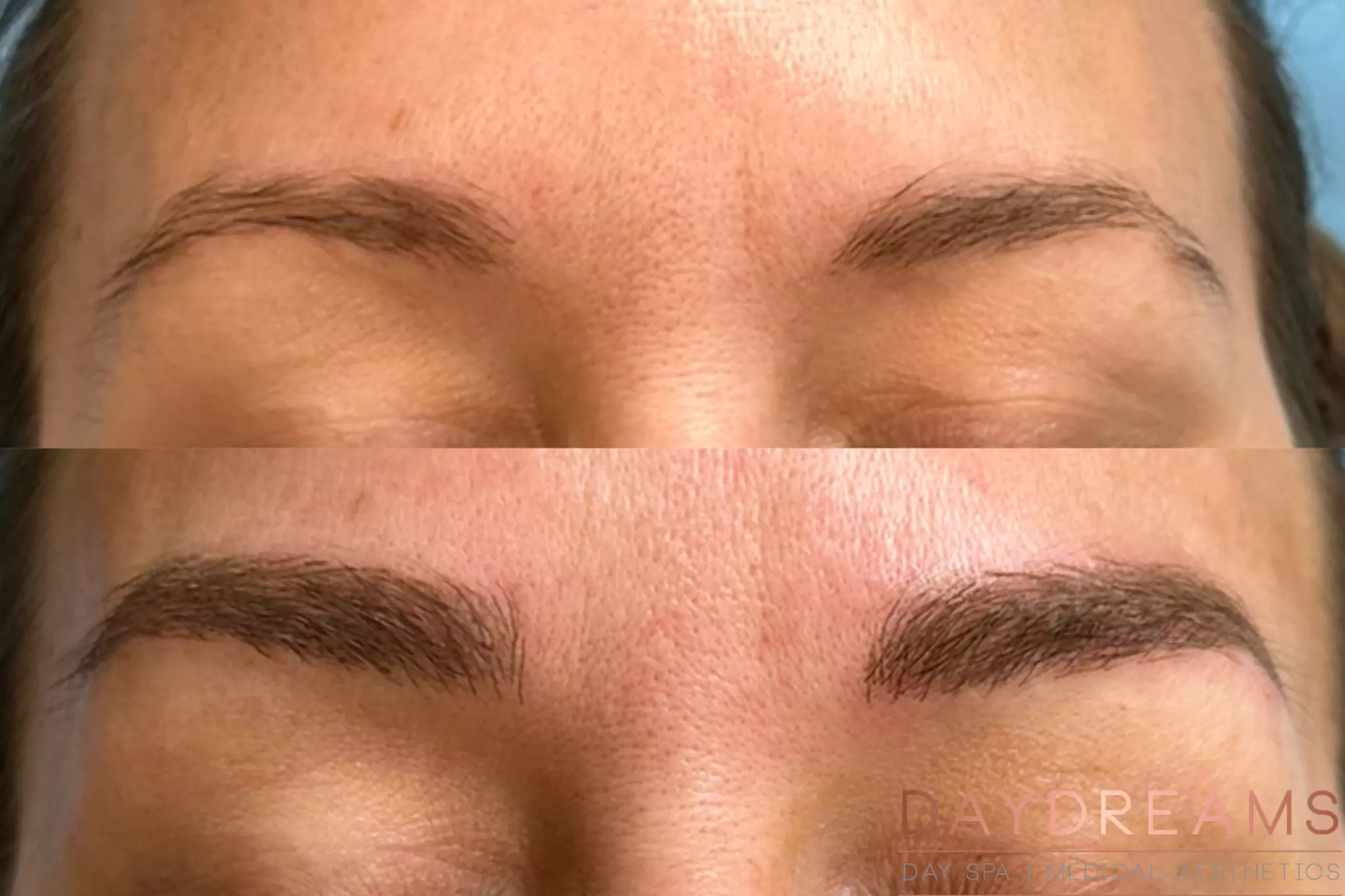 Microblading before-after image 1