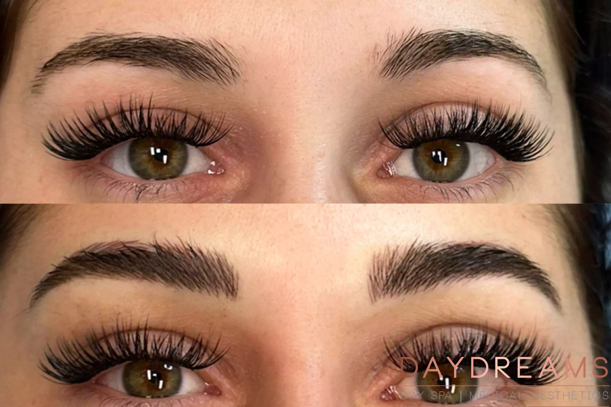 Microblading before-after image 5