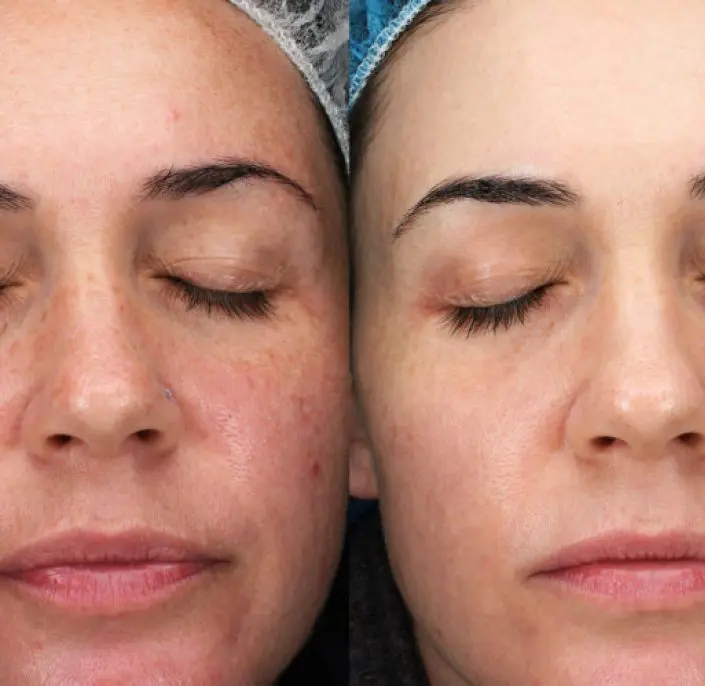 We Will Find the Best Treatment Plan for Your Skin We Will Find the Best Treatment Plan for Your Skin