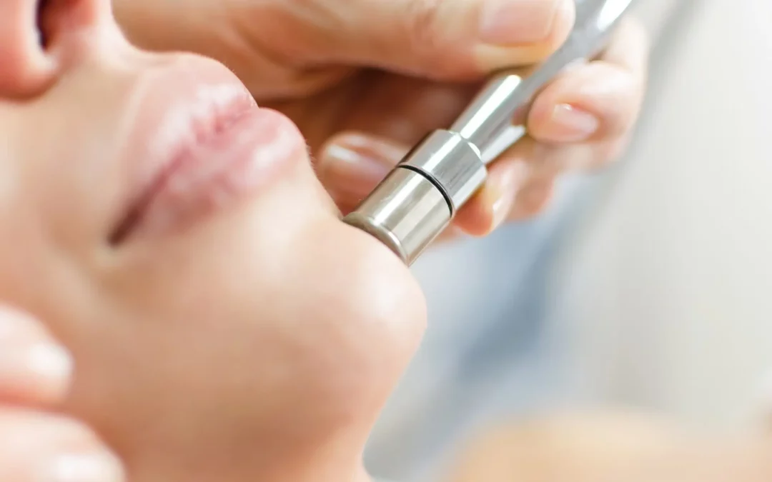 What Is Microdermabrasion