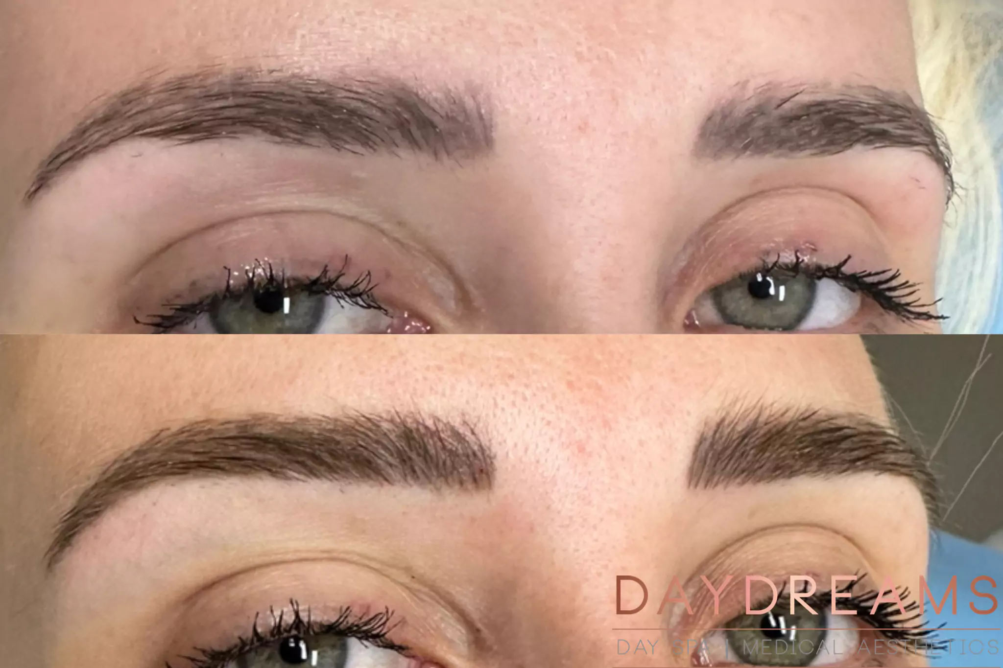 2-Microblading-Before-After before-afrer